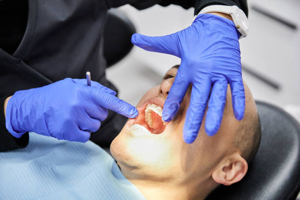 Best Emergency Wisdom Tooth Extraction in Ardia, CA