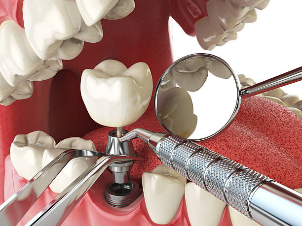 Best 24-Hour Emergency Dental Care in Ardia, CA
